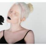 Modella con albinismo mostra quanto sia bello il contrasto tra la pelle candica e le labbra nere
