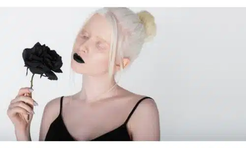 Modella con albinismo mostra quanto sia bello il contrasto tra la pelle candica e le labbra nere