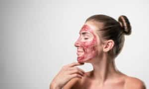 Donna mostra come fare lo scrub per levare le cellule morte dal viso