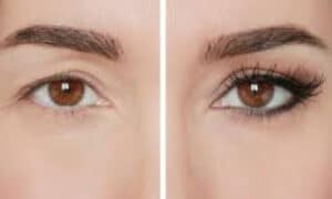gli occhi infossati che vengono risaltati con il trucco correttivo